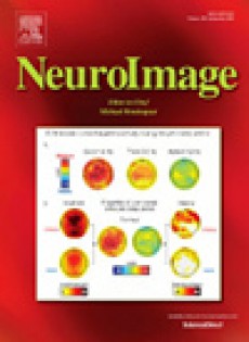 Neuroimage